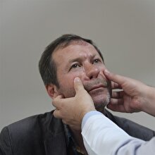 8 yıl sonra burnuna kavuştu
