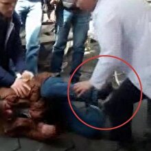 Müdahale ettiği hasta tarafından tekmelenen hemşirenin zor anları