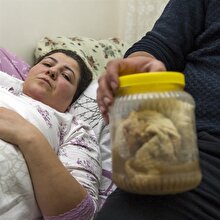 Kanser olabilirsin denilen kadının karnından bir kavanoz gazlı bez çıktı