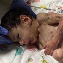 Sosyal medya günlerce bu fotoğrafı konuştu! Son halini görünce çok şaşıracaksınız