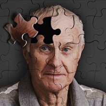 Bu hastalığın sırrı ne, kimler risk altında? İşte alzheimer hakkında bilinmeyenler