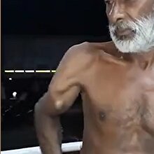 Kolunu 360 derece döndürebilen adam herkesi şoke etti!