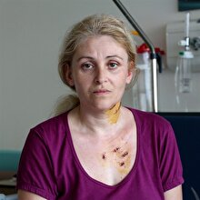 Eşinin bıçakla yaraladığı kadın: Boğazımı kesmeye çalıştı