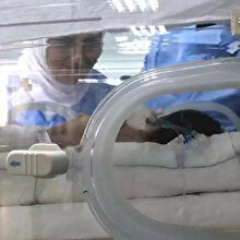 Mide ve bağırsakları dışarıda doğan bebek sağlığına kavuştu