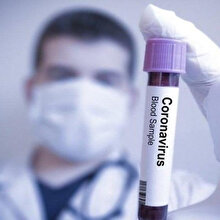 😷 Sağlık Bakanlığı'ndan koronavirüs açıklaması: Hastanede 6-8 saat canlı kalabiliyor