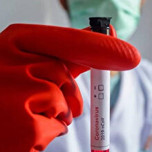 Çin duyurdu: Koronavirüs için aşıyı bulduk 💉