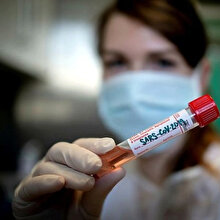 Türk Profesör salgının domuzdan bulaşabileceğini iddia etti
