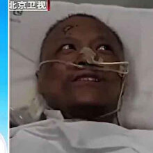 Çinli iki doktor koronavirüsü yendi ancak ten renkleri değişti