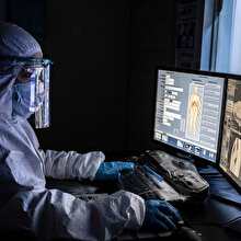 Akciğer tomografisiyle erken teşhis, Covid-19'a karşı hayat kurtardı