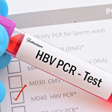 Yurt dışına çıkacaklar için PCR testi ücreti belli oldu