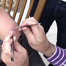 😲Genç kadının kolundan çıkanlar şaşkına çevirdi