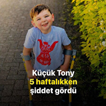 Ampüte çocuk Tony 1 milyon pound bağış topladı