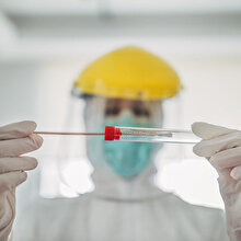 Türk bilim insanları geliştirdi: COVID-19 tanısı için yeni sistem