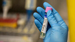 Spain confirms 1st monkeypox death in Europe