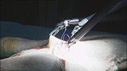Da Vinci Robotu Türkiye’de
