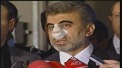 Taner Yıldız Hastaneden Çıktı