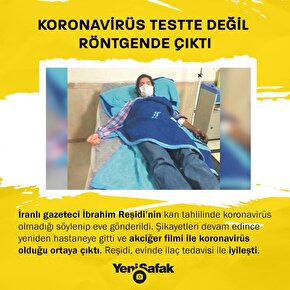 Koronavirüs testte değil röntgenden çıktı