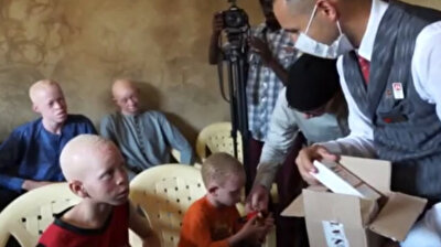Turkey’s national flag carrier helps albinos in Africa