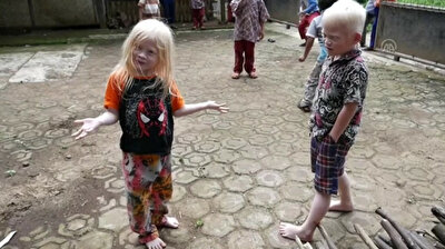 Albino kids play in Indonesian village as world marks int'l Albinism Awareness Day