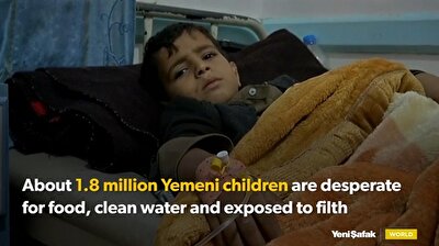 Starving Yemeni children struggle to battle cholera as conflicts continue