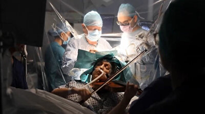 Musician plays violin while undergoing brain surgery in UK