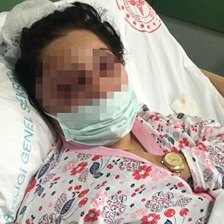 Eski eşi tarafından acımasızca darp edilen kadın: Hep tutuklu kalsın istiyorum