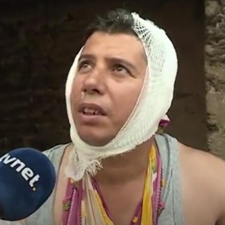 Manavgatta alevlerin arasında kalan vatandaş: Evden annemi babamı kurtardım kendim yangının ortasında kaldım