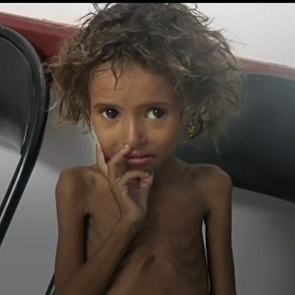 Yemen’de yüzbinler dehşet içinde