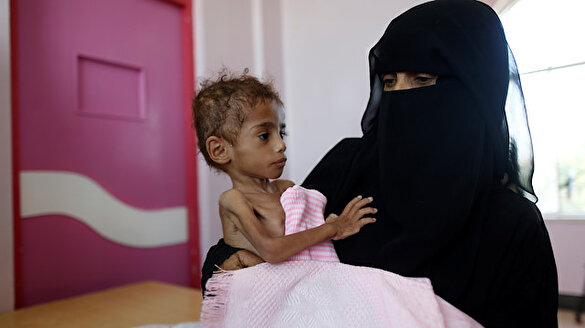 Yemen'de milyonlar açlıktan ölüyor