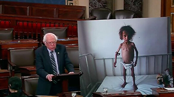 ABD'li senatör kendi ülkesine seslendi: Yemenli çocukları biz öldürdük!