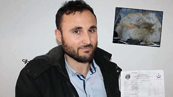 Ekmeğin içinden çıkan vida boğazını yırttı