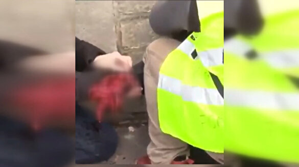 Fransa'da eyleme katılan bir kişinin eli koptu