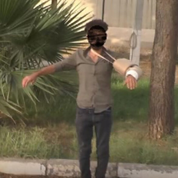 Eylem hazırlığındaki PKK'lı terörist, kolundaki alçıya yerleştirdiği bomba ile yakalandı