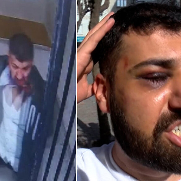 'Nezarette defalarca kafama vurdular' diyen şüphelinin parmaklıklara kafa attığı görüntüler ortaya çıktı