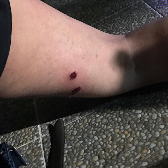 İşgalci İsrail polisi AA muhabirini canlı yayında vurdu