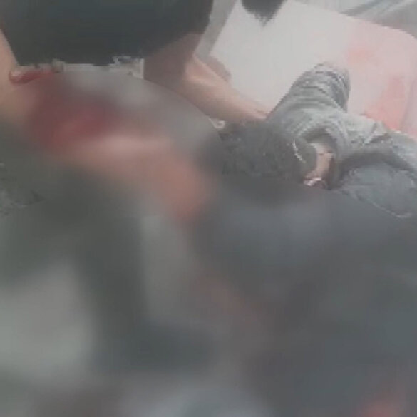 Afrin'de YPG/PKK'dan hastaneye saldırı: 13 ölü, 27 yaralı