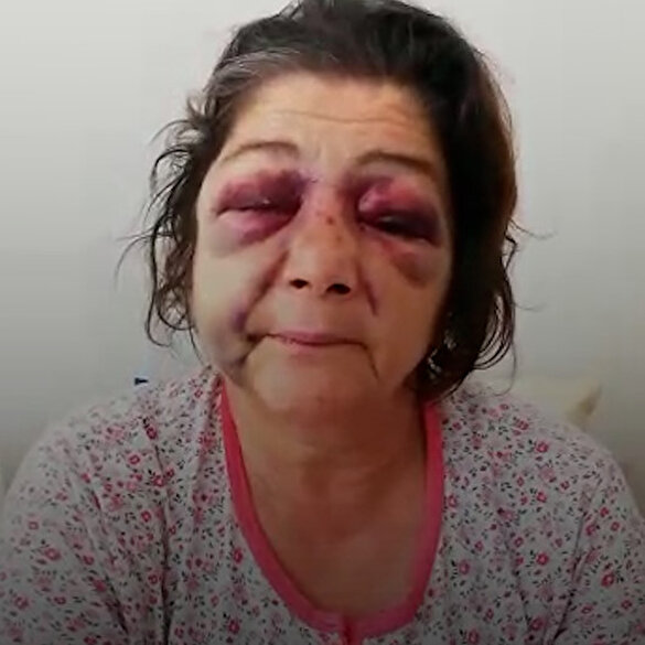 'Park bakımsız' diyen kadını CHP'li Başkan Ahmet Latif Karadeniz'in adamları dövdü
