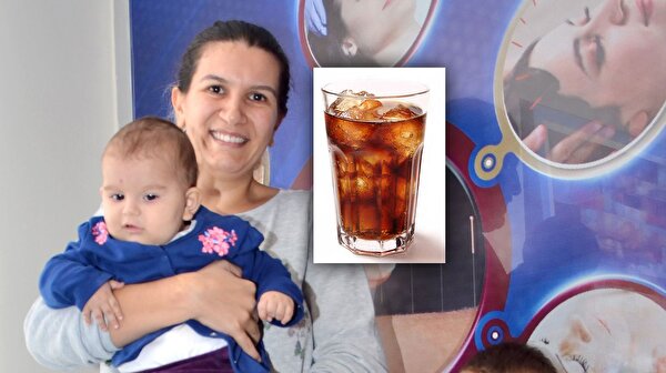 Gunde 5 Litre Kola Icen Kadinin Kemikleri Eridi