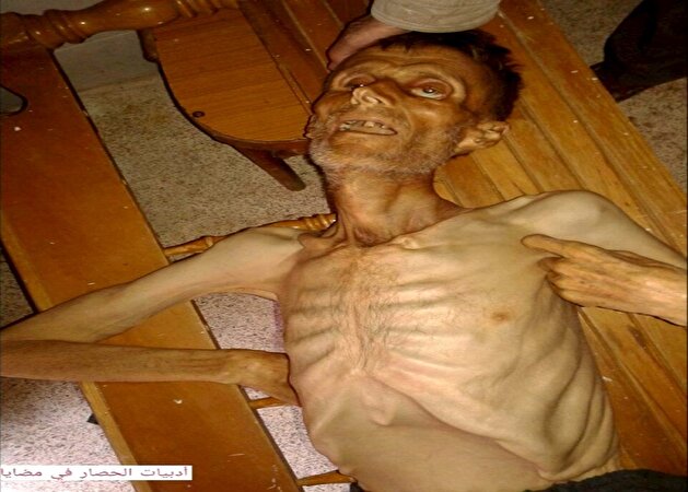 Over 20,000 Syrian children starving in Madaya