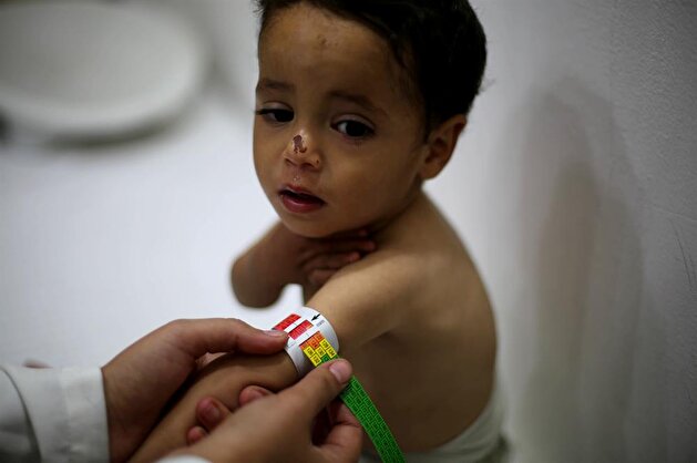Infant death in Eastern Ghouta