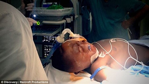Mother abandons teenager suffering from cancer