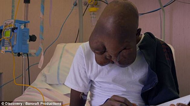 Mother abandons teenager suffering from cancer