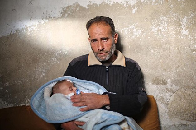 Baby Karim at risk of losing his other eye
