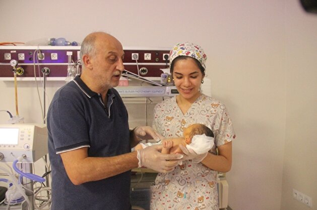 Two-headed Syrian baby born in Turkey’s south