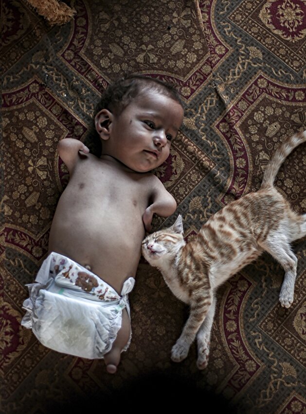 Syrian father's love for his son born without limbs melts hearts everywhere