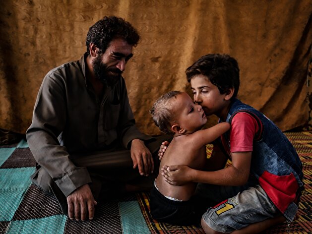3-year-old Syrian baby born without arms and legs awaits world's help