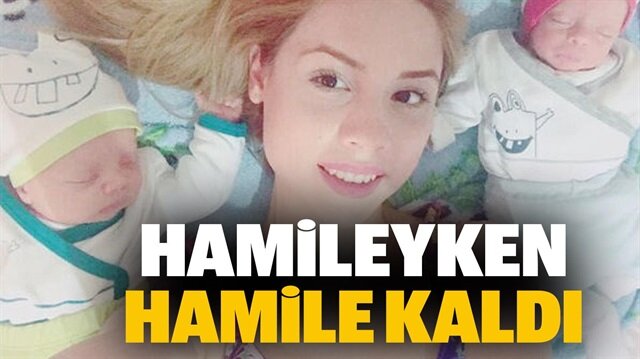 Hamileyken Hamile Kaldi 2 Bebegini Ayni Anda Kucagina Aldi