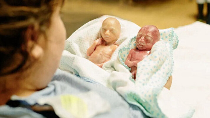 <p>Kanada’da 22 haftalık dünyaya gelen iki kardeş, dünyanın en erken doğan ikizleri olarak Guinness Rekorlar Kitabı’na girdi. Doğumları öncesinde hayatta kalmaları için neredeyse hiç şans verilmeyen bebekler geçen sene gerçekleşen doğumda 126 gün erken dünyaya geldi. Daha önceki rekor ise 2018’de ABD’nin Iowa eyaletinde 125 gün erken doğan ikizlere aitti.</p><p><br></p>