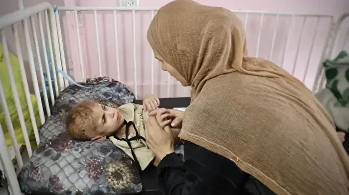 <p>الطفلة مي.. "وردة" أذوى التجويع الإسرائيلي جسدها بغزة</p><p><br></p>