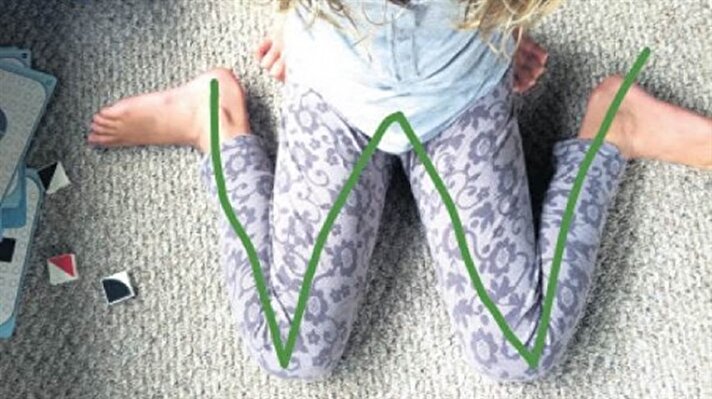  Çocukların kalçasını yere koyup dizlerinden bacaklarını arkaya doğru bükerek 'W' oturuş pozisyonu sağlık problemlerine yol açıyor.
